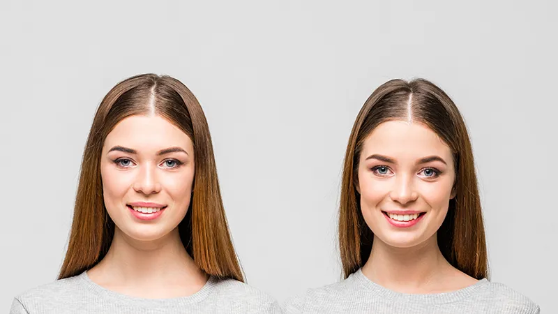 TopBroker funkcijos: dublikatų atpažinimas